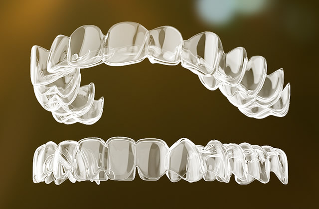 透明牙齿矫正器怎么戴 隐形牙齿矫正器如何取下来